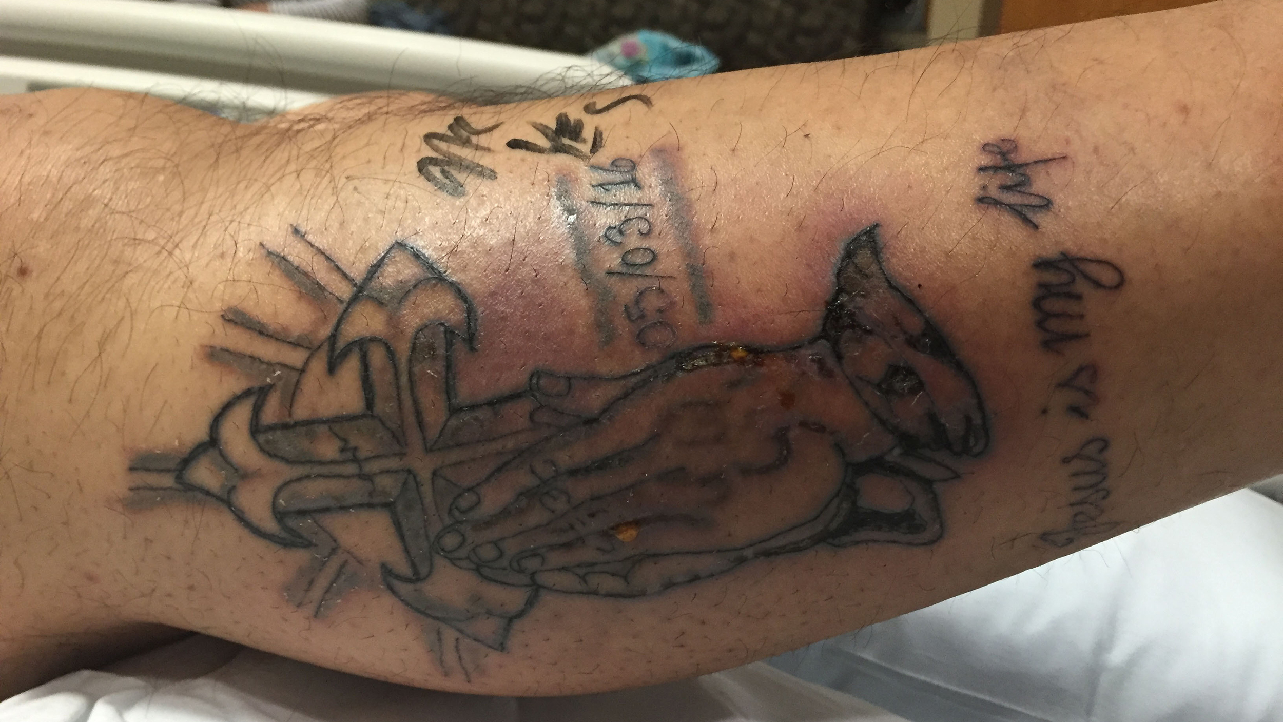 31 Year Old Man Dies After Swimming With Fresh Tattoo regarding size 2500 X 1407