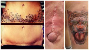 Image Result For Pictures Of Tattoos To Cover Stretch Marks On intended for sizing 1366 X 768