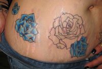 Stretch Marks General Tattoo Discussion Ink Trails Tattoo Forum pertaining to sizing 2628 X 2088