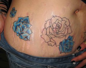 Stretch Marks General Tattoo Discussion Ink Trails Tattoo Forum pertaining to sizing 2628 X 2088