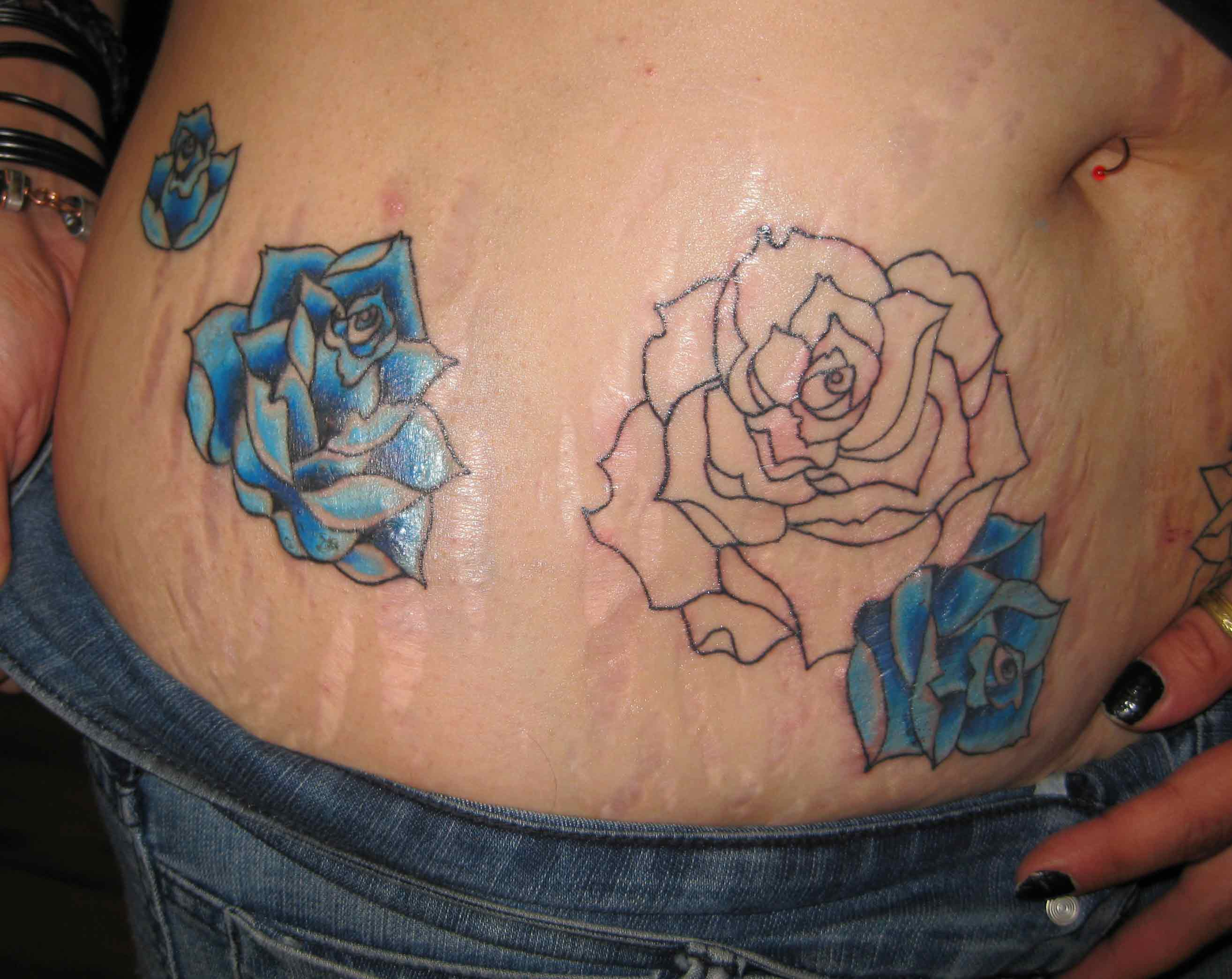 Stretch Marks General Tattoo Discussion Ink Trails Tattoo Forum with size 2...