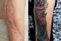 Tattoos Over Burn Scars Burn Scar Cover Healed Tattoozone with dimensions 795 X 1004