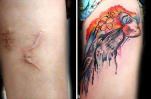 These Beautiful Tattoos Helped People Cover Their Haunting Scars with regard to measurements 1920 X 1267