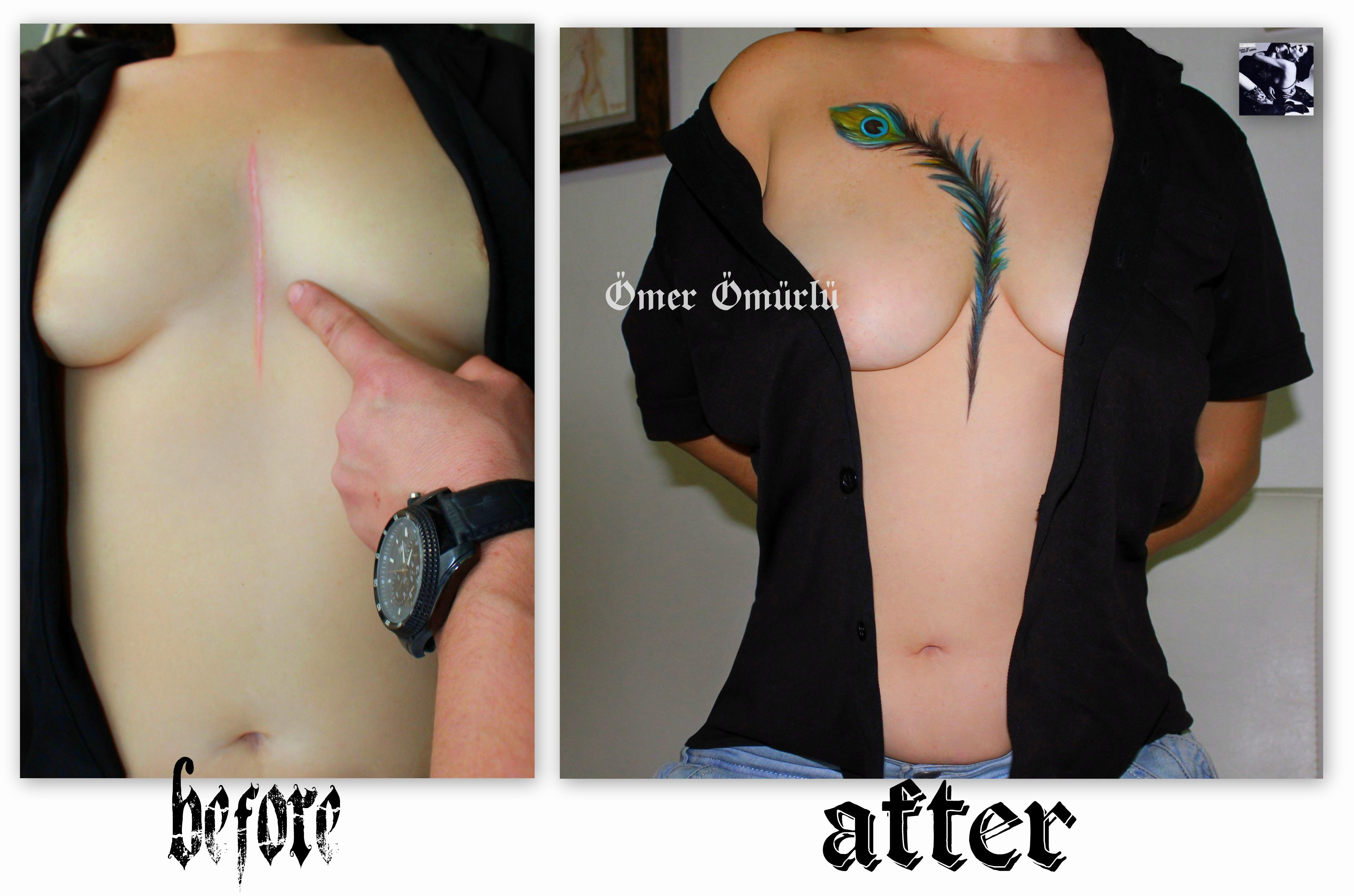 Covering A Heart Surgery Scar With Feather Tattootattoo Mer pertaining to dimensions 3803 X 2518