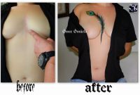 Covering A Heart Surgery Scar With Feather Tattootattoo Mer pertaining to proportions 3803 X 2518