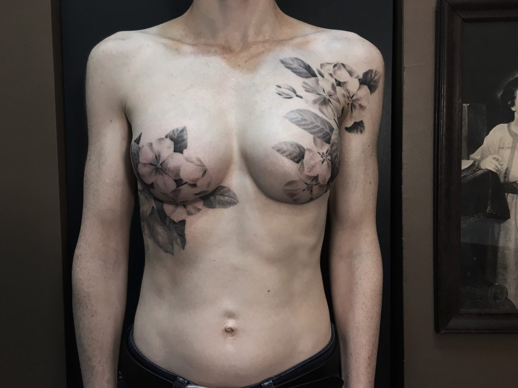 Reclaiming Their Beauty Tattoo Artist Inks Exquisite Flowers Over with regard to size 1700 X 1275